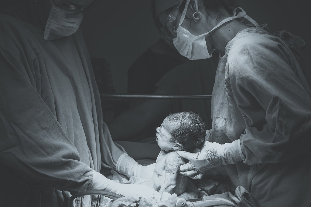Natural Birth Vs C-Section: Everything You Need To Know